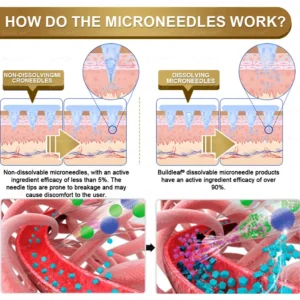𝐁𝐮𝐢𝐥𝐝𝐋𝐞𝐚𝐟® 𝐆𝐋𝐏-𝟏 Slimming & health NANO MICRONEEDLE PATCH