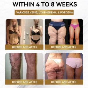 𝐁𝐮𝐢𝐥𝐝𝐋𝐞𝐚𝐟® 𝐆𝐋𝐏-𝟏 Slimming & health NANO MICRONEEDLE PATCH