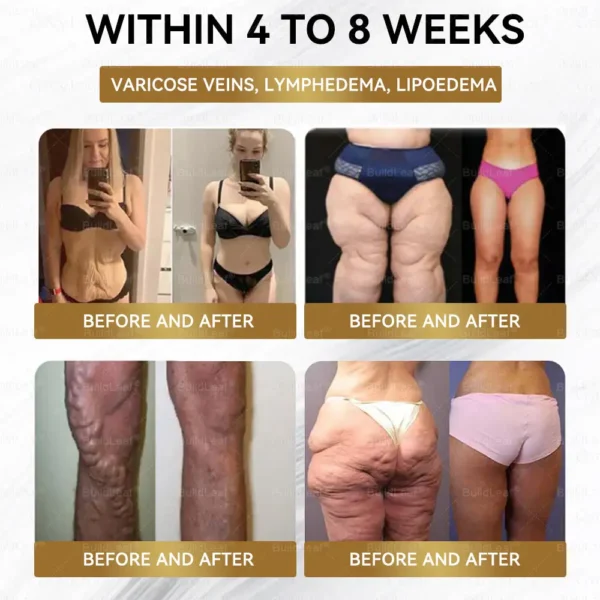 𝐁𝐮𝐢𝐥𝐝𝐋𝐞𝐚𝐟® 𝐆𝐋𝐏-𝟏 Slimming & health NANO MICRONEEDLE PATCH