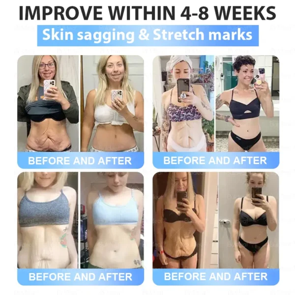 🎯 FDA Registered | Up to 80% OFF | BuildLeaf® GLP-1 Slimming Patch with Collagen + Matrixyl 3000