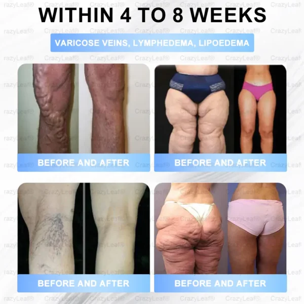 🎯 FDA Registered | Up to 80% OFF | BuildLeaf® GLP-1 Slimming Patch with Collagen + Matrixyl 3000