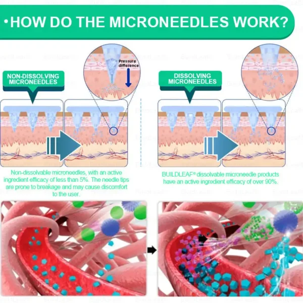 🏥Official Store | BuildLeaf® GLP-1 Nano-Microneedle Patch with Collagen & Matrixyl 3000 丨Obesity,Cardiovascular Diseas, Diabetes, Sleep Apnea, Joint Problems and More