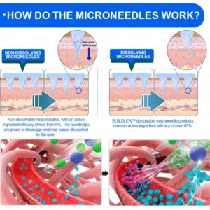 🏥Official Store | BuildLeaf® SMGT-GLP-1 Nano Microneedle Patch with Collagen & Matrixyl 3000 丨Obesity,Cardiovascular Diseas, Diabetes, Sleep Apnea, Joint Problems and More