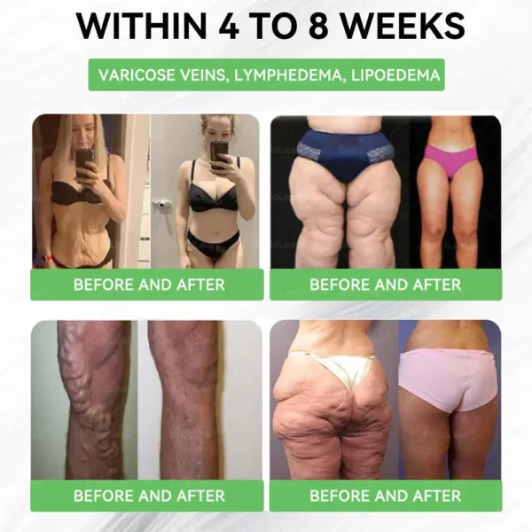 𝐁𝐮𝐢𝐥𝐝𝐋𝐞𝐚𝐟® 𝐆𝐋𝐏-𝟏 𝐏𝐫𝐨 𝐍𝐚𝐭𝐮𝐫𝐚𝐥 𝐇𝐞𝐚𝐥𝐭𝐡 𝐎𝐫𝐚𝐥 𝐒𝐨𝐥𝐮𝐭𝐢𝐨𝐧 (𝐉𝐮𝐬𝐭 𝐨𝐧𝐜𝐞 𝐚 𝐝𝐚𝐲, 𝐯𝐢𝐬𝐢𝐛𝐥𝐞 𝐫𝐞𝐬𝐮𝐥𝐭𝐬 𝐢𝐧 𝟕 𝐝𝐚𝐲𝐬) ✅ 𝐓𝐚𝐫𝐠𝐞𝐭𝐬: 𝐰𝐞𝐢𝐠𝐡𝐭 𝐦𝐚𝐧𝐚𝐠𝐞𝐦𝐞𝐧𝐭, 𝐜𝐚𝐫𝐝𝐢𝐨𝐯𝐚𝐬𝐜𝐮𝐥𝐚𝐫 𝐡𝐞𝐚𝐥𝐭𝐡, 𝐛𝐥𝐨𝐨𝐝 𝐬𝐮𝐠𝐚𝐫 𝐛𝐚𝐥𝐚𝐧𝐜𝐞, 𝐬𝐥𝐞𝐞𝐩 𝐚𝐩𝐧𝐞𝐚, 𝐠𝐮𝐭 𝐬𝐮𝐩𝐩𝐨𝐫𝐭, 𝐣𝐨𝐢𝐧𝐭 𝐝𝐢𝐬𝐜𝐨𝐦𝐟𝐨𝐫𝐭 & 𝐦𝐨𝐫𝐞.