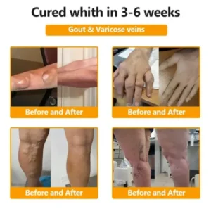 ๐๐๐๐๐ยฎ๐๐จ๐ญ๐ฎ๐ฅ๐ข๐ง๐ฎ๐ฆ ๐๐จ๐ฑ๐ข๐ง & ๐๐๐ ๐๐๐ง๐จ๐ฆ ๐๐๐ข๐ง-๐๐๐ฅ๐ข๐๐ ๐๐จ๐ง๐ ๐๐๐๐ฅ๐ข๐ง๐ ๐๐ซ๐๐๐ฆ