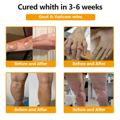 ๐๐๐๐๐ยฎ๐๐จ๐ญ๐ฎ๐ฅ๐ข๐ง๐ฎ๐ฆ ๐๐จ๐ฑ๐ข๐ง & ๐๐๐ ๐๐๐ง๐จ๐ฆ ๐๐๐ข๐ง-๐๐๐ฅ๐ข๐๐ ๐๐จ๐ง๐ ๐๐๐๐ฅ๐ข๐ง๐ ๐๐ซ๐๐๐ฆ