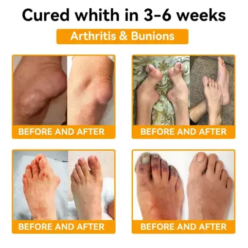 ๐๐๐๐๐ยฎ๐๐จ๐ญ๐ฎ๐ฅ๐ข๐ง๐ฎ๐ฆ ๐๐จ๐ฑ๐ข๐ง & ๐๐๐ ๐๐๐ง๐จ๐ฆ ๐๐๐ข๐ง-๐๐๐ฅ๐ข๐๐ ๐๐จ๐ง๐ ๐๐๐๐ฅ๐ข๐ง๐ ๐๐ซ๐๐๐ฆ