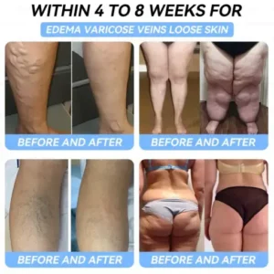 𝐷𝑜𝑟𝑚𝑜𝑟𝑛𝑎® 𝑁𝐻𝑀𝑅𝐶-𝑇𝑖𝑟𝑧𝑒𝑝𝑎𝑡𝑖𝑑𝑒 𝑁𝑎𝑛𝑜 𝑀𝑖𝑐𝑟𝑜𝑛𝑒𝑒𝑑𝑙𝑒 𝑃𝑎𝑡𝑐ℎ