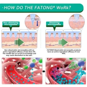 𝑭𝑨𝑻𝑶𝑵𝑮® 𝑺𝑴𝑮𝑻-𝑮𝑳𝑷-1 𝑵𝒂𝒏𝒐 𝑴𝒊𝒄𝒓𝒐𝒏𝒆𝒆𝒅𝒍𝒆 𝑺𝒍𝒊𝒎𝒎𝒊𝒏𝒈 𝑷𝒂𝒕𝒄𝒉