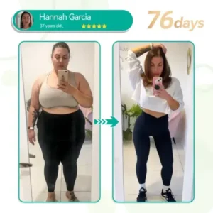 𝑭𝑨𝑻𝑶𝑵𝑮® 𝑺𝑴𝑮𝑻-𝑮𝑳𝑷-1 𝑵𝒂𝒏𝒐 𝑴𝒊𝒄𝒓𝒐𝒏𝒆𝒆𝒅𝒍𝒆 𝑺𝒍𝒊𝒎𝒎𝒊𝒏𝒈 𝑷𝒂𝒕𝒄𝒉