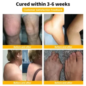 ๐๐๐๐๐๐๐โข ๐๐๐ Poison ๐๐๐ฏ๐๐ง๐๐๐ ๐๐จ๐ข๐ง๐ญ ๐๐ง๐ ๐๐จ๐ง๐ ๐๐ก๐๐ซ๐๐ฉ๐ฒ ๐๐ซ๐๐๐ฆ