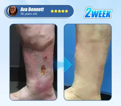 ADFIRE® Diabetic Skin Revolution – 6-IN-1 Clinical Solution