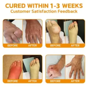 ADNOON® 💧Magnesium Oil & Bee Venom Joint Healing Spray