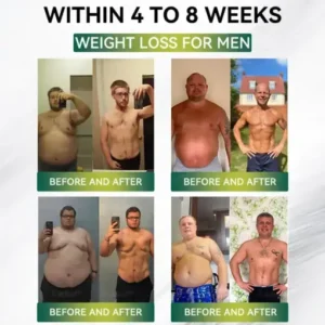 Buildleaf® SMGT-GLP-1 Nano Microneedle Patch with Collagen Peptides &Matrixyl 3000