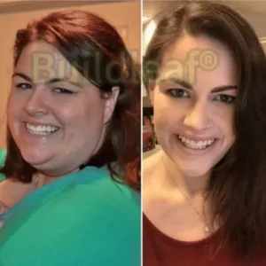 Buildleaf® SMGT-GLP-1 Nano Microneedle Patch with Collagen Peptides &Matrixyl 3000