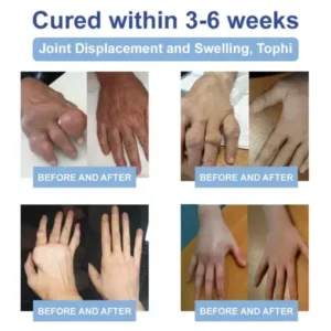 FATONG® Magnesium Pain Healing Bone Cream