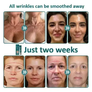 Flysmus® Botox Jellyfish Venom Peptide Nanoliposome Sculpting Anti-Wrinkle Cream