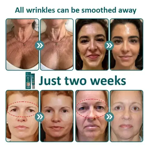 Flysmus® Botox Jellyfish Venom Peptide Nanoliposome Sculpting Anti-Wrinkle Cream