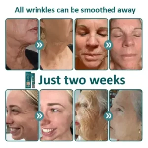 Flysmus® Botox Jellyfish Venom Peptide Nanoliposome Sculpting Anti-Wrinkle Cream