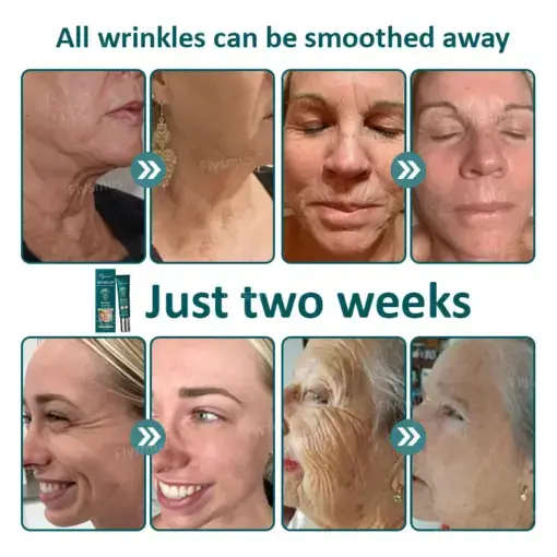 Flysmus® Botox Jellyfish Venom Peptide Nanoliposome Sculpting Anti-Wrinkle Cream