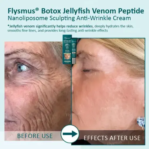 Flysmus® Botox Jellyfish Venom Peptide Nanoliposome Sculpting Anti-Wrinkle Cream