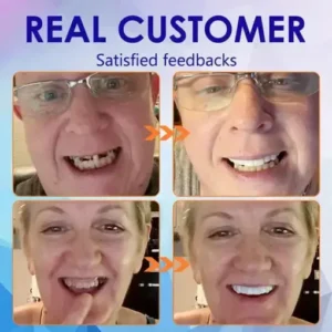 SmileFitPro™-New Generation Flexible Full Denture Solution