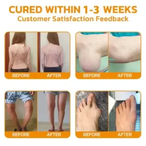 VENOLYX™ Bee Venom Rapid Therapy Joint Cream