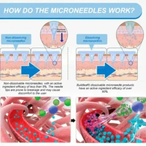 𝐵uil𝗱𝐿ea𝐟® 𝑺𝑀𝗚T-𝑮𝐋𝑃-1 𝐒limming & 𝐻ealth 𝑁ano 𝑀icroneedle 𝑃atch