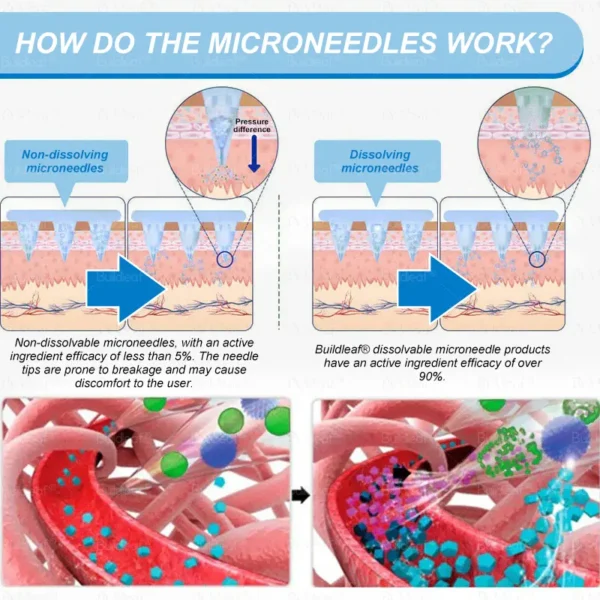 𝐵uil𝗱𝐿ea𝐟® 𝑺𝑀𝗚T-𝑮𝐋𝑃-1 𝐒limming & 𝐻ealth 𝑁ano 𝑀icroneedle 𝑃atch with Collagen & Matrixyl 3000 丨Obesity,Cardiovascular Diseas, Diabetes, Sleep Apnea, Joint Problems and More