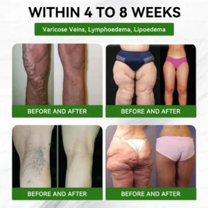 𝑩𝒖𝐢𝒍𝒅𝑳𝒆𝐚𝒇® GL𝐏-1 20-𝒊𝒏-1 Slim & Vitality 𝖮𝗋𝖺𝗅 𝙎𝙤𝙡𝙪𝙩𝙞𝙤𝙣 𝐰𝐢𝐭𝐡 𝐌𝐨𝐫𝐢𝐧𝐠𝐚, Ashwagandha,100B CFU Probiotic ,𝐎𝐦𝐞𝐠𝐚-𝟑,𝐍𝐀𝐃 & 𝐍𝐌𝐍 𝐟𝐨𝐫 Obesity, Diabetes, Digestive & Cardiovascular Health, Joint Support, Skin Firming, Anti-Aging, Stress Relief & Energy Boost.