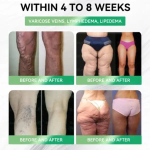 CVS Online 𝖲𝗍𝗈𝗋𝖾 | 𝘽𝙪𝙞𝙡𝙙𝙇𝙚𝙖𝙛® 𝗚𝗟𝗣-𝟭 𝟖-𝗶𝗻-𝟭 𝗦𝗹𝗶𝗺 & 𝑯𝒆𝒂𝒍𝒕𝒉𝐲 𝑶𝒓𝒂𝒍 𝑺𝒐𝒍𝒖𝒕𝒊𝒐𝒏(𝑂𝑛𝑐𝑒 𝑎 𝑑𝑎𝑦, 𝑣𝑖𝑠𝑖𝑏𝑙𝑒 𝑟𝑒𝑠𝑢𝑙𝑡𝑠 𝑖𝑛 7 𝑑𝑎𝑦𝑠)  ✅ 𝗦𝘂𝗽𝗽𝗼𝗿𝘁𝘀 𝗼𝗯𝗲𝘀𝗶𝘁𝘆, 𝗰𝗮𝗿𝗱𝗶𝗼𝘃𝗮𝘀𝗰𝘂𝗹𝗮𝗿 𝗵𝗲𝗮𝗹𝘁𝗵, 𝗱𝗶𝗮𝗯𝗲𝘁𝗲𝘀, 𝘀𝗹𝗲𝗲𝗽 𝗮𝗽𝗻𝗲𝗮, 𝗴𝘂𝘁 𝗵𝗲𝗮𝗹𝘁𝗵, 𝗷𝗼𝗶𝗻𝘁 𝗶𝘀𝘀𝘂𝗲𝘀, 𝐰𝐡𝐢𝐥𝐞 𝐚𝐥𝐬𝐨 𝐟𝐢𝐫𝐦𝐢𝐧𝐠 𝐭𝐡𝐞 𝐬𝐤𝐢𝐧 𝐚𝐧𝐝 𝐛𝐨𝐨𝐬𝐭𝐢𝐧𝐠 𝐞𝐧𝐞𝐫𝐠𝐲.