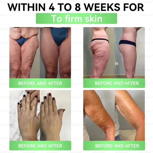 CVS Online: 𝑩𝒖𝐢𝒍𝒅𝑳𝒆𝐚𝒇® GL𝐏-1 8-𝒊𝒏-1 𝙁𝙞𝙩 & 𝙑𝙞𝙩𝙖𝙡 𝖮𝗋𝖺𝗅 𝙎𝙤𝙡𝙪𝙩𝙞𝙤𝙣 (𝑱𝒖𝒔𝒕 𝒐𝒏𝒄𝒆 𝒂 𝒅𝒂𝒚, 𝒗𝒊𝒔𝒊𝒃𝒍𝒆 𝒄𝒉𝒂𝒏𝒈𝒆𝒔 𝒊𝒏 7 𝒅𝒂𝒚𝒔) ✅ 𝑭𝒐𝒓 𝒐𝒃𝒆𝒔𝒊𝒕𝒚, 𝒄𝒂𝒓𝒅𝒊𝒐𝒗𝒂𝒔𝒄𝒖𝒍𝒂𝒓 𝒉𝒆𝒂𝒍𝒕𝒉, 𝒅𝒊𝒂𝒃𝒆𝒕𝒆𝒔, 𝒔𝒍𝒆𝒆𝒑 𝒂𝒑𝒏𝒆𝒂, 𝒈𝒖𝒕 𝒉𝒆𝒂𝒍𝒕𝒉, 𝒋𝒐𝒊𝒏𝒕 𝒊𝒔𝒔𝒖𝒆𝒔, 𝒂𝒏𝒅 𝒎𝒐𝒓𝒆