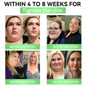 CVS Online: 𝑩𝒖𝐢𝒍𝒅𝑳𝒆𝐚𝒇® GL𝐏-1 8-𝒊𝒏-1 𝙁𝙞𝙩 & 𝙑𝙞𝙩𝙖𝙡 𝖮𝗋𝖺𝗅 𝙎𝙤𝙡𝙪𝙩𝙞𝙤𝙣 (𝑱𝒖𝒔𝒕 𝒐𝒏𝒄𝒆 𝒂 𝒅𝒂𝒚, 𝒗𝒊𝒔𝒊𝒃𝒍𝒆 𝒄𝒉𝒂𝒏𝒈𝒆𝒔 𝒊𝒏 7 𝒅𝒂𝒚𝒔) ✅ 𝑭𝒐𝒓 𝒐𝒃𝒆𝒔𝒊𝒕𝒚, 𝒄𝒂𝒓𝒅𝒊𝒐𝒗𝒂𝒔𝒄𝒖𝒍𝒂𝒓 𝒉𝒆𝒂𝒍𝒕𝒉, 𝒅𝒊𝒂𝒃𝒆𝒕𝒆𝒔, 𝒔𝒍𝒆𝒆𝒑 𝒂𝒑𝒏𝒆𝒂, 𝒈𝒖𝒕 𝒉𝒆𝒂𝒍𝒕𝒉, 𝒋𝒐𝒊𝒏𝒕 𝒊𝒔𝒔𝒖𝒆𝒔, 𝒂𝒏𝒅 𝒎𝒐𝒓𝒆