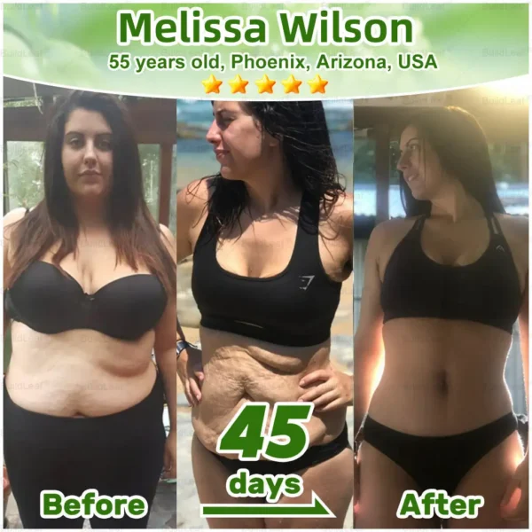 CVS Online: 𝑩𝒖𝐢𝒍𝒅𝑳𝒆𝐚𝒇® GL𝐏-1 8-𝒊𝒏-1 𝙁𝙞𝙩 & 𝙑𝙞𝙩𝙖𝙡 𝖮𝗋𝖺𝗅 𝙎𝙤𝙡𝙪𝙩𝙞𝙤𝙣 (𝑱𝒖𝒔𝒕 𝒐𝒏𝒄𝒆 𝒂 𝒅𝒂𝒚, 𝒗𝒊𝒔𝒊𝒃𝒍𝒆 𝒄𝒉𝒂𝒏𝒈𝒆𝒔 𝒊𝒏 7 𝒅𝒂𝒚𝒔) ✅ 𝑭𝒐𝒓 𝒐𝒃𝒆𝒔𝒊𝒕𝒚, 𝒄𝒂𝒓𝒅𝒊𝒐𝒗𝒂𝒔𝒄𝒖𝒍𝒂𝒓 𝒉𝒆𝒂𝒍𝒕𝒉, 𝒅𝒊𝒂𝒃𝒆𝒕𝒆𝒔, 𝒔𝒍𝒆𝒆𝒑 𝒂𝒑𝒏𝒆𝒂, 𝒈𝒖𝒕 𝒉𝒆𝒂𝒍𝒕𝒉, 𝒋𝒐𝒊𝒏𝒕 𝒊𝒔𝒔𝒖𝒆𝒔, 𝒂𝒏𝒅 𝒎𝒐𝒓𝒆