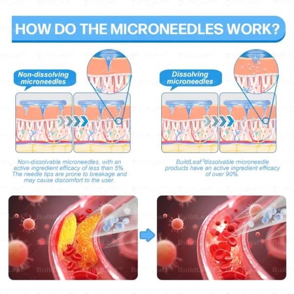 Official FDA Store·𝐁𝐮𝐢𝐥𝗱𝐋𝐞𝐚𝐟®𝐒𝐥𝐢𝐦 & 𝐅𝐢𝐫𝐦 𝐍𝐚𝐧𝐨 𝐌𝐢𝐜𝐫𝐨𝐧𝐞𝐞𝐝𝐥𝐞 𝐏𝐚𝐭𝐜𝐡 𝐰𝐢𝐭𝐡 𝐌𝐨𝐫𝐢𝐧𝐠𝐚, 𝐎𝐦𝐞𝐠𝐚-𝟑, 𝐂𝐨𝐥𝐥𝐚𝐠𝐞𝐧 𝐏𝐞𝐩𝐭𝐢𝐝𝐞𝐬, 𝐍𝐀𝐃 & 𝐍𝐌𝐍 𝐟𝐨𝐫 𝐎𝐛𝐞𝐬𝐢𝐭𝐲, 𝐂𝐚𝐫𝐝𝐢𝐨𝐯𝐚𝐬𝐜𝐮𝐥𝐚𝐫 𝐃𝐢𝐬𝐞𝐚𝐬𝐞, 𝐃𝐢𝐚𝐛𝐞𝐭𝐞𝐬, 𝐒𝐥𝐞𝐞𝐩 𝐀𝐩𝐧𝐞𝐚, 𝐉𝐨𝐢𝐧𝐭 𝐏𝐫𝐨𝐛𝐥𝐞𝐦𝐬, 𝐒𝐤𝐢𝐧 𝐅𝐢𝐫𝐦𝐢𝐧𝐠, 𝐀𝐧𝐭𝐢-𝐀𝐠𝐢𝐧𝐠, 𝐚𝐧𝐝 𝐌𝐨𝐫𝐞