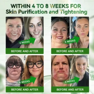 🔥𝐵𝑢𝑖𝑙𝑑𝐿𝑒𝑎𝑓® 𝑶𝒇𝒇𝒊𝒄𝒊𝒂𝒍 𝑺𝒕𝒐𝒓𝒆 𝗚𝗟𝗣-𝟭 𝟳 𝗗𝗮𝘆𝘀 𝗚𝘂𝘁 𝗖𝗹𝗲𝗮𝗻𝘀𝗲 & 𝗦𝗹𝗶𝗺 𝗦𝘂𝗽𝗽𝗼𝗿𝘁 𝗢𝗿𝗮𝗹 𝗦𝗼𝗹𝘂𝘁𝗶𝗼𝗻 for Digestive Cleanse ,𝑶𝒃𝒆𝒔𝒊𝒕𝒚, 𝑴𝒆𝒏𝒕𝒂𝒍 𝑪𝒍𝒂𝒓𝒊𝒕𝒚,𝑫𝒊𝒂𝒃𝒆𝒕𝒆𝒔, 𝑫𝒊𝒈𝒆𝒔𝒕𝒊𝒗𝒆 & 𝑪𝒂𝒓𝒅𝒊𝒐𝒗𝒂𝒔𝒄𝒖𝒍𝒂𝒓 𝑯𝒆𝒂𝒍𝒕𝒉, 𝑱𝒐𝒊𝒏𝒕 𝑺𝒖𝒑𝒑𝒐𝒓𝒕, 𝑺𝒌𝒊𝒏 𝑭𝒊𝒓𝒎𝒊𝒏𝒈, 𝑨𝒏𝒕𝒊-𝑨𝒈𝒊𝒏𝒈, 𝑺𝒕𝒓𝒆𝒔𝒔 𝑹𝒆𝒍𝒊𝒆𝒇 & 𝑬𝒏𝒆𝒓𝒈𝒚 𝑩𝒐𝒐𝒔𝒕