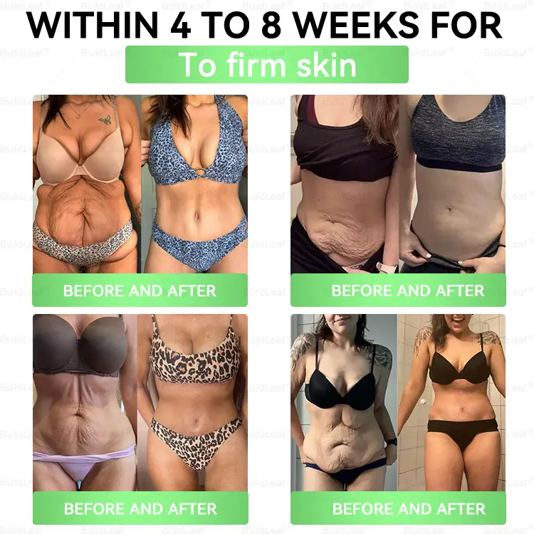 ๐๐๐๐ ๐๐๐๐๐ | ๐ฉ๐๐ข๐๐
๐ณ๐๐๐ยฎ๐จโโ๏ธ๐ฎ๐ณ๐ท-1 ๐พ๐๐๐๐๐ ๐ณ๐๐๐ ๐ถ๐๐๐ ๐บ๐๐๐๐๐๐๐๐ (Just once a day,visible changes in 7 days) For obesity, cardiovascular health, diabetes, sleep apnea, joint issues, and more