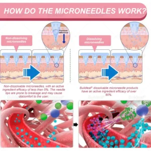 US 🏥FDA Store | 𝐵uil𝗱𝐿ea𝐟® 𝐆𝐋𝐏-𝟏 Support 𝑁ano 𝑀icroneedle 𝑃atch with Collagen & Matrixyl 3000 丨Obesity,Cardiovascular Diseas, Diabetes, Sleep Apnea, Joint Problems and More (Pink)