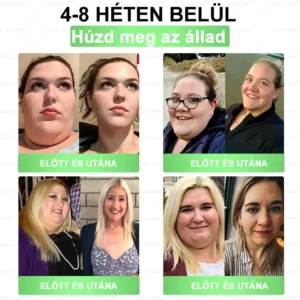 𝐁𝐮𝐢𝐥𝐝𝐋𝐞𝐚𝐟® 𝐆𝐋𝐏-𝟏 𝟖-𝐢𝐧-𝟏 𝐒𝐥𝐢𝐦 & 𝐇𝐞𝐚𝐥𝐭𝐡𝐲 𝐎𝐫á𝐥𝐢𝐬 𝐌𝐞𝐠𝐨𝐥𝐝á𝐬 💚🌿 𝐓á𝐦𝐨𝐠𝐚𝐭𝐣𝐚 𝐚𝐳 𝐞𝐥𝐡í𝐳á𝐬 𝐤𝐞𝐳𝐞𝐥é𝐬é𝐭, 𝐚 𝐬𝐳í𝐯- é𝐬 é𝐫𝐫𝐞𝐧𝐝𝐬𝐳𝐞𝐫𝐢 𝐞𝐠é𝐬𝐳𝐬é𝐠𝐞𝐭, 𝐚 𝐜𝐮𝐤𝐨𝐫𝐛𝐞𝐭𝐞𝐠𝐬é𝐠𝐞𝐭, 𝐚𝐳 𝐚𝐥𝐯á𝐬𝐢 𝐚𝐩𝐧𝐨é𝐭, 𝐚 𝐛é𝐥𝐫𝐞𝐧𝐝𝐬𝐳𝐞𝐫 𝐞𝐠é𝐬𝐳𝐬é𝐠é𝐭, 𝐦𝐢𝐤ö𝐳𝐛𝐞𝐧 𝐟𝐞𝐬𝐳𝐞𝐬í𝐭𝐢 𝐚 𝐛ő𝐫𝐭 is𝐬𝐧ö𝐯𝐞𝐥𝐢 𝐚𝐳 𝐞𝐧𝐞𝐫𝐠𝐢á𝐭.✅