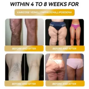 𝐂𝐙𝐓𝐈𝐂𝐋𝐄® 𝐌𝐚𝐠𝐧𝐞𝐭𝐢𝐜 𝐄𝐧𝐞𝐫𝐠𝐲 𝐆𝐞-𝐒𝐭𝐨𝐧𝐞 𝐌𝐚𝐩𝐥𝐞 𝐄𝐚𝐫𝐫𝐢𝐧𝐠𝐬