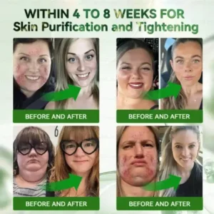 ๐ฉ๐๐๐๐
๐ณ๐๐๐ยฎ ๐ฎ๐ณ๐ท-1 7-๐ซ๐๐ ๐ฎ๐๐ ๐ช๐๐๐๐๐๐ & ๐บ๐๐๐ ๐บ๐๐๐๐๐๐ ๐ถ๐๐๐ ๐บ๐๐๐๐๐๐๐