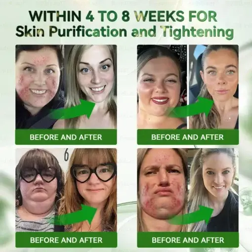 ๐ฉ๐๐๐๐
๐ณ๐๐๐ยฎ ๐ฎ๐ณ๐ท-1 7-๐ซ๐๐ ๐ฎ๐๐ ๐ช๐๐๐๐๐๐ & ๐บ๐๐๐ ๐บ๐๐๐๐๐๐ ๐ถ๐๐๐ ๐บ๐๐๐๐๐๐๐