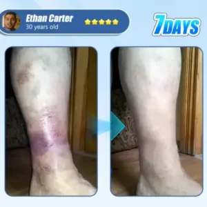 ADFIRE® Diabetic Skin Revolution