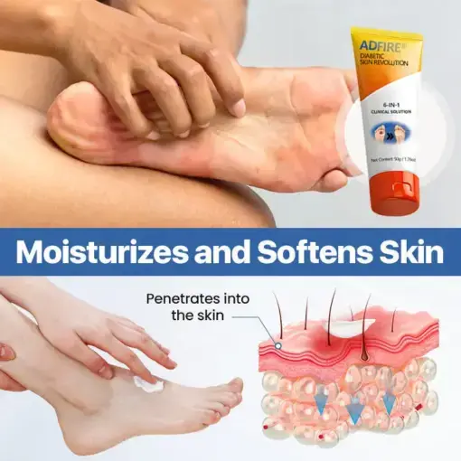 ADFIRE® Diabetic Skin Revolution