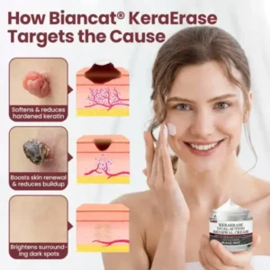 Biancat® KeraErase Dual-Action Renewal Cream