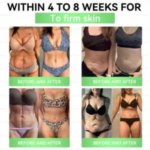 CVS Online | 𝘽𝙪𝙞𝙡𝙙𝙇𝙚𝙖𝙛® 𝗚𝗟𝗣-𝟭 𝟐𝟎-𝐢𝐧-𝟏 𝐒𝐥𝐢𝐦&𝐇𝐞𝐚𝐥𝐭𝐡 𝐎𝐫𝐚𝐥 𝐒𝐨𝐥𝐮𝐭𝐢𝐨𝐧(𝑶𝒏𝒄𝒆 𝒂 𝒅𝒂𝒚,𝒓𝒆𝒔𝒖𝒍𝒕𝒔 𝒊𝒏 7 𝒅𝒂𝒚𝒔),𝑾𝒊𝒕𝒉 100 𝑩𝒊𝒍𝒍𝒊𝒐𝒏 𝑪𝑭𝑼 𝑨𝒄𝒕𝒊𝒗𝒆 𝑷𝒓𝒐𝒃𝒊𝒐𝒕𝒊𝒄𝒔✅𝑺𝒖𝒑𝒑𝒐𝒓𝒕𝒔 𝒘𝒆𝒊𝒈𝒉𝒕 𝒎𝒂𝒏𝒂𝒈𝒆𝒎𝒆𝒏𝒕,𝒉𝒆𝒂𝒓𝒕 𝒉𝒆𝒂𝒍𝒕𝒉,𝒅𝒊𝒂𝒃𝒆𝒕𝒆𝒔,𝒈𝒖𝒕 & 𝒘𝒐𝒎𝒆𝒏’𝒔 𝒉𝒆𝒂𝒍𝒕𝒉,𝒘𝒉𝒊𝒍𝒆 𝒇𝒊𝒓𝒎𝒊𝒏𝒈 𝒔𝒌𝒊𝒏&𝒃𝒐𝒐𝒔𝒕𝒊𝒏𝒈 𝒆𝒏𝒆𝒓𝒈𝒚.