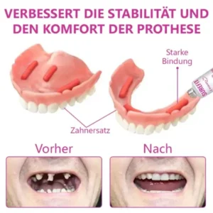 Ceoerty™ Thermischer Prothesenkleber