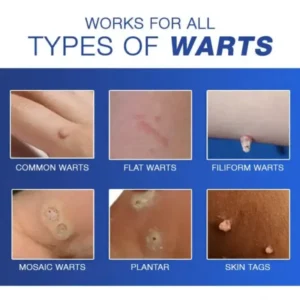 Cvreoz® Wart Eraser Pro