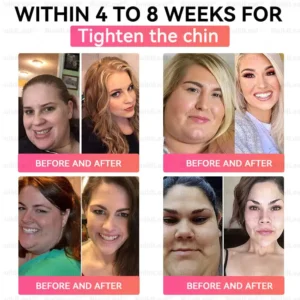 FDA Store | 𝐵uil𝗱𝐿ea𝐟® 𝐆𝐋𝐏-𝟏 Support 𝑁ano 𝑀icroneedle 𝑃atch with Collagen & Matrixyl 3000 丨Obesity,Cardiovascular Diseas, Diabetes, Sleep Apnea, Joint Problems and More