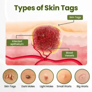 LOVILDS® MagneErase Renewal Cream